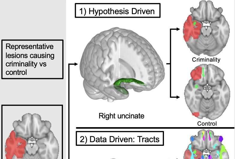 Injury to specific brain connections could explain some people’s criminal behavior, study finds
