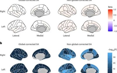 Brain cortex structure linked to mental abilities and psychiatric disorders