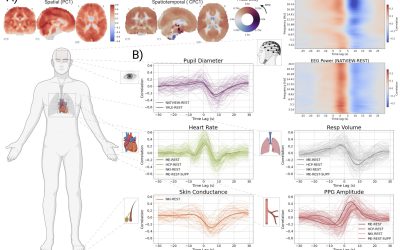 Autonomic nervous system is key driver of global fMRI signal, study finds