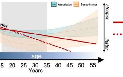 Study maps changes in brain’s ‘neural noise’ from childhood to adulthood